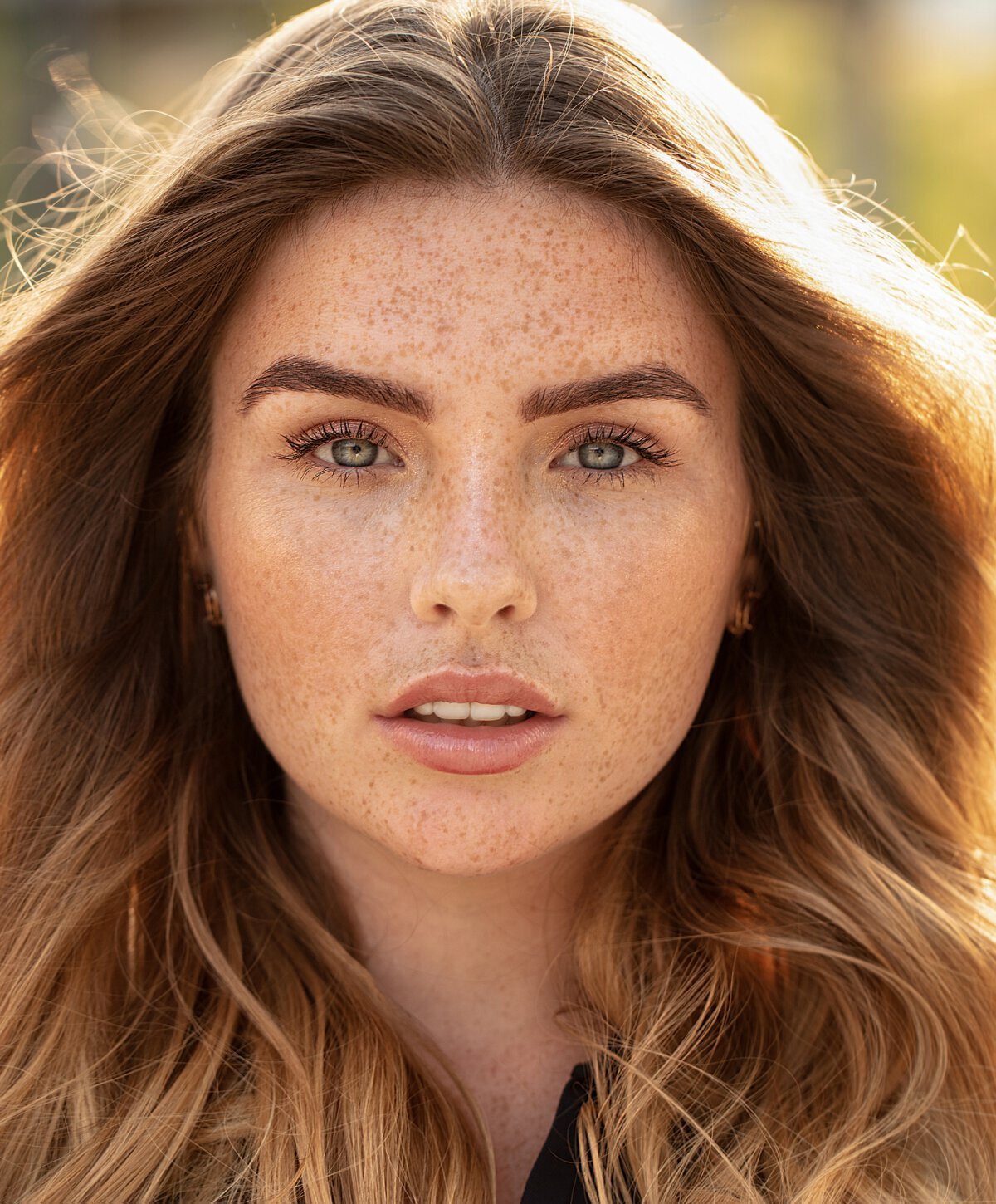 beverly hills botox model with freckles